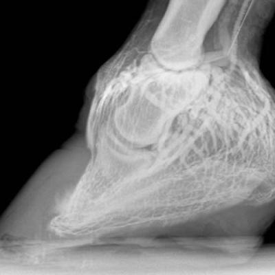 Radiografia