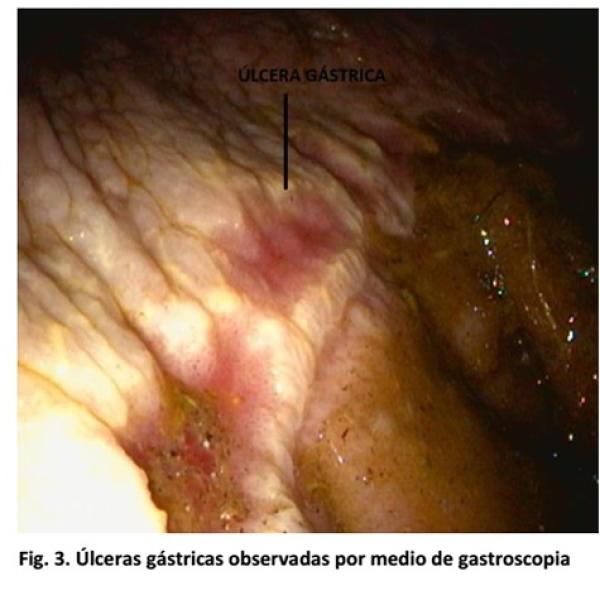 Sindrome de Ulcera Gástrica en Equinos